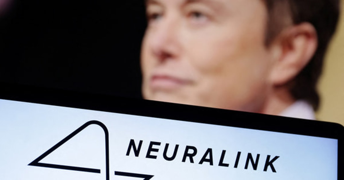 Илон Маск объявил о выпуске чипа Neuralink для восстановления зрения